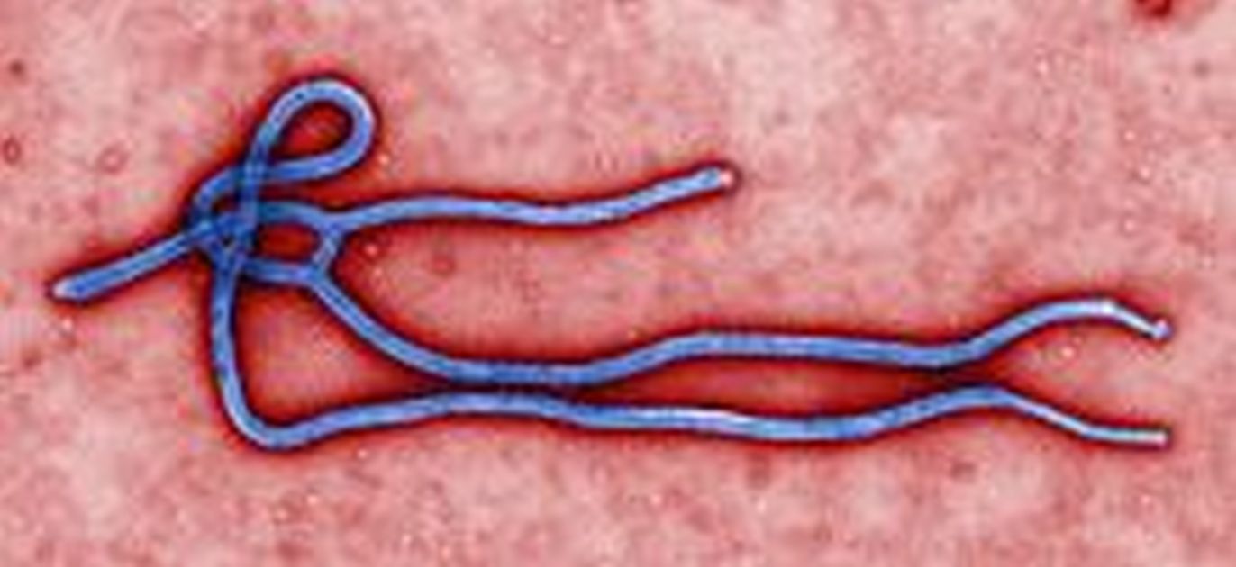 Israeli Scientists Find Way To Spread Autism With Ebola Cure