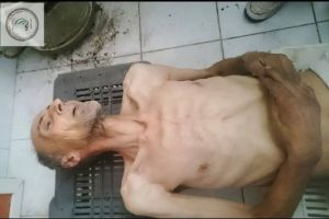 A man in Madaya, Syria