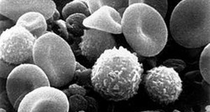 European White Blood Cells More Likely To Let Pathogens In Unmolested