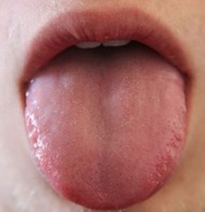 tongue