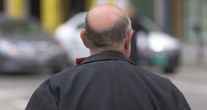 New Solar Energy Technology Uses Glare From Bald Men’s Heads